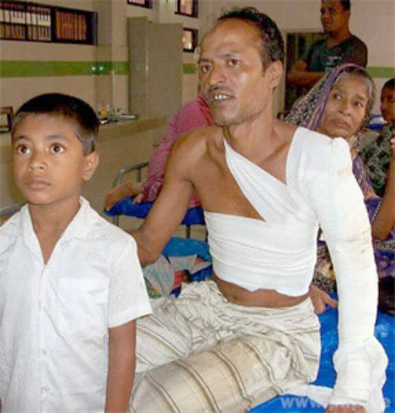 hile-fuer-bangladesh-06-plastische-chirurgie-leipzig-wachsmuth-voelpel.jpg 
